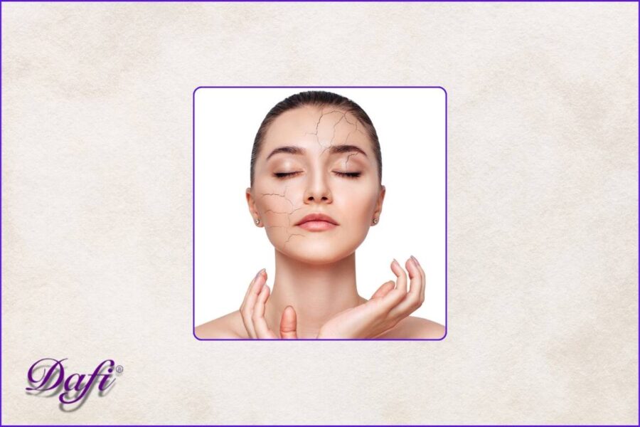 پوست دهیدراته چیست؟ راه درمان و کنترل!