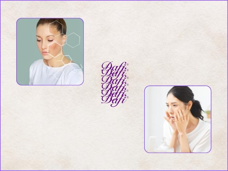 تاثیر استرس بر پیری پوست صورت و نحوه جلوگیری از آن