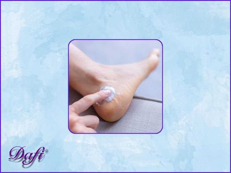 ترک پا چگونه شکل میگیرد؟