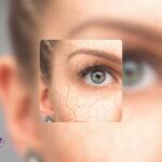 تفاوت پوست خشک و دهیدراته چیست؟