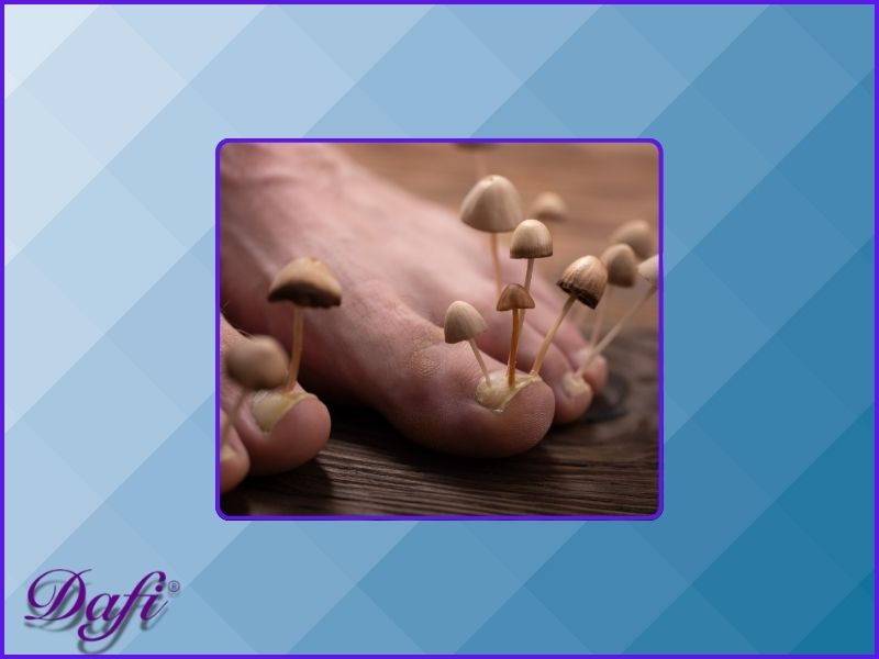 روشهای پیشگیری از عفونت قارچی در ناخن چیست؟