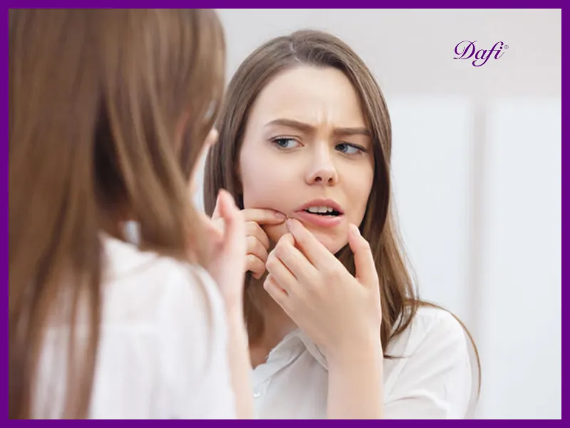 چرا جوش روی چانه ایجاد میشود؟