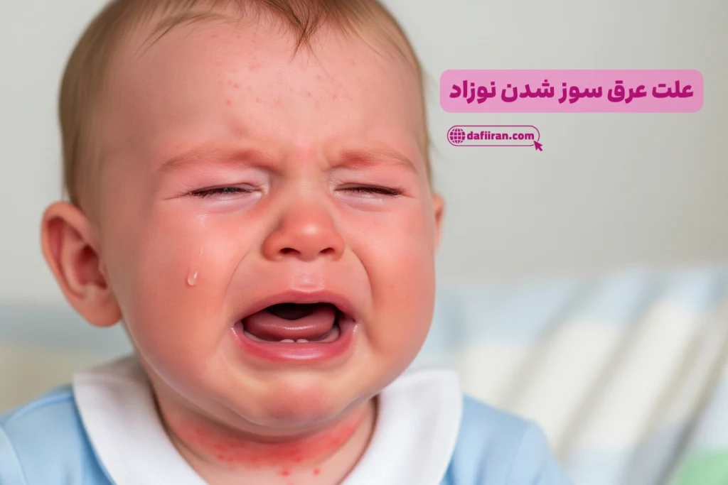 علت عرق سوز شدن نوزاد