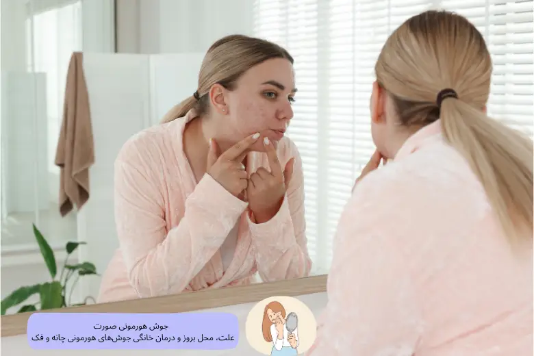 جوش هورمونی صورت | علت، محل بروز و درمان خانگی جوش‌های هورمونی چانه و فک | مجله دافی