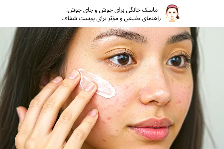 ماسک خانگی برای جوش و جای جوش: راهنمای طبیعی و مؤثر برای پوست شفاف | مجله دافی