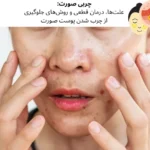 چربی صورت: علتها، درمان قطعی و روشهای جلوگیری از چرب شدن پوست صورت | مجله دافی
