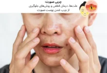 چربی صورت: علت‌ها، درمان قطعی و روش‌های جلوگیری از چرب شدن پوست صورت | مجله دافی